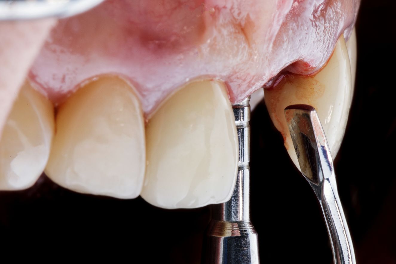 Rocky Mountain Dental Specialists (Full Site)